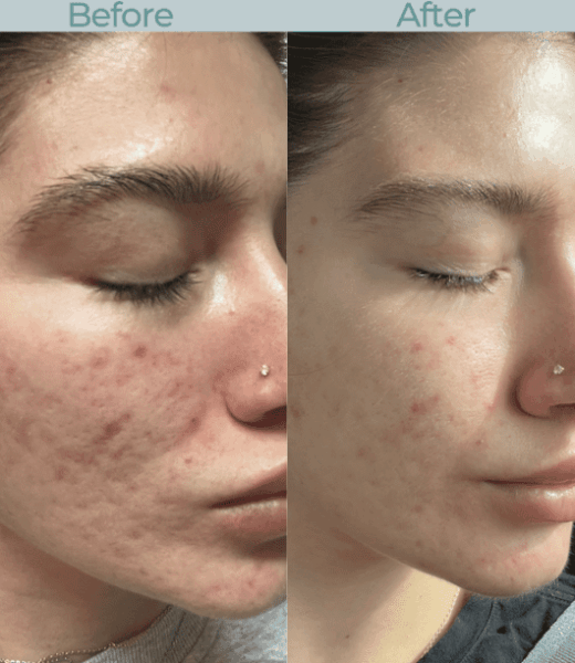 CO2 Lift Pro Mask